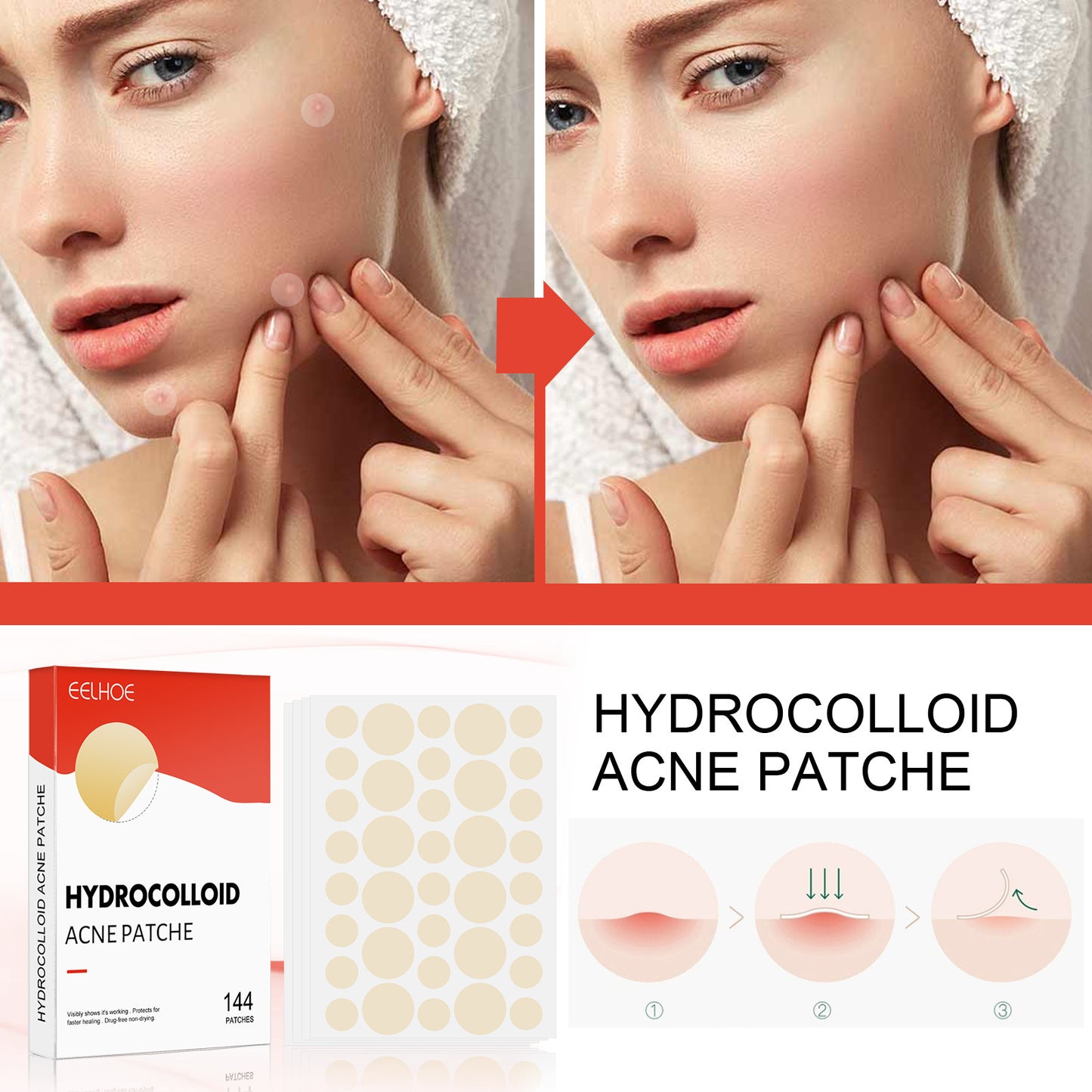 Hydrocolloid Acne Patch Makeup Closed Acne Patch